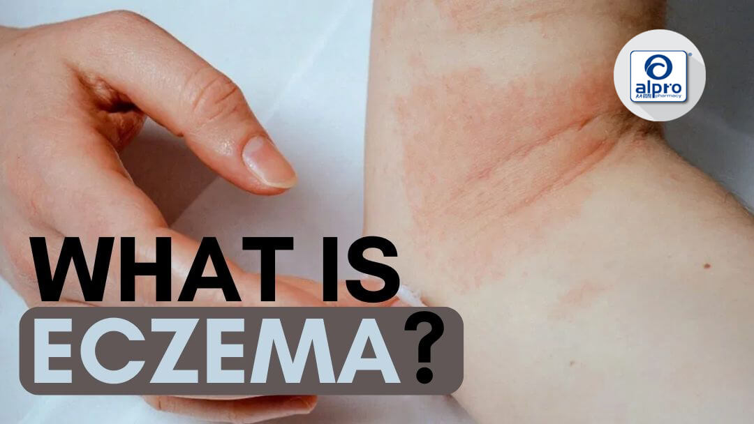 Featured image for What is eczema?