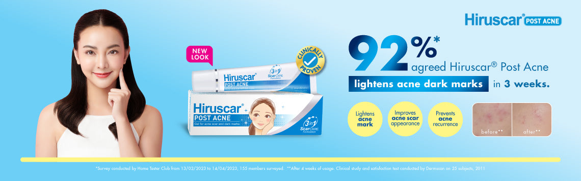 254-hiruscar banner image