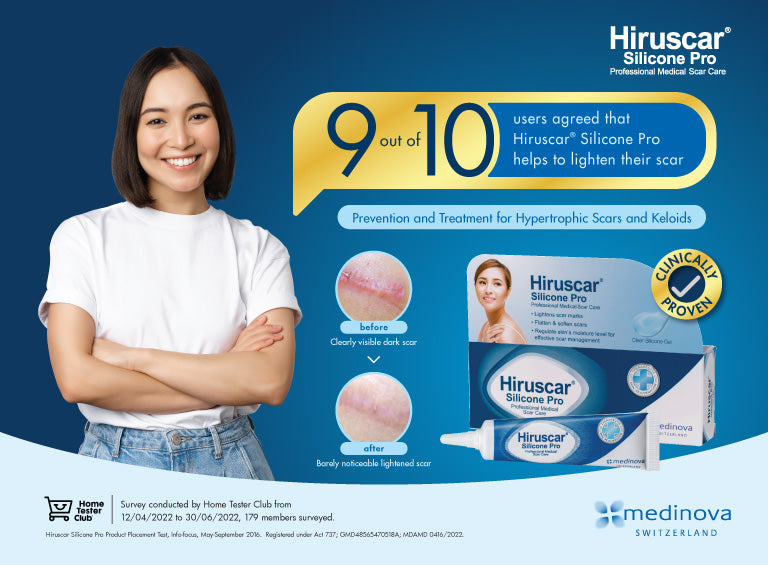 254-hiruscar mobile banner image