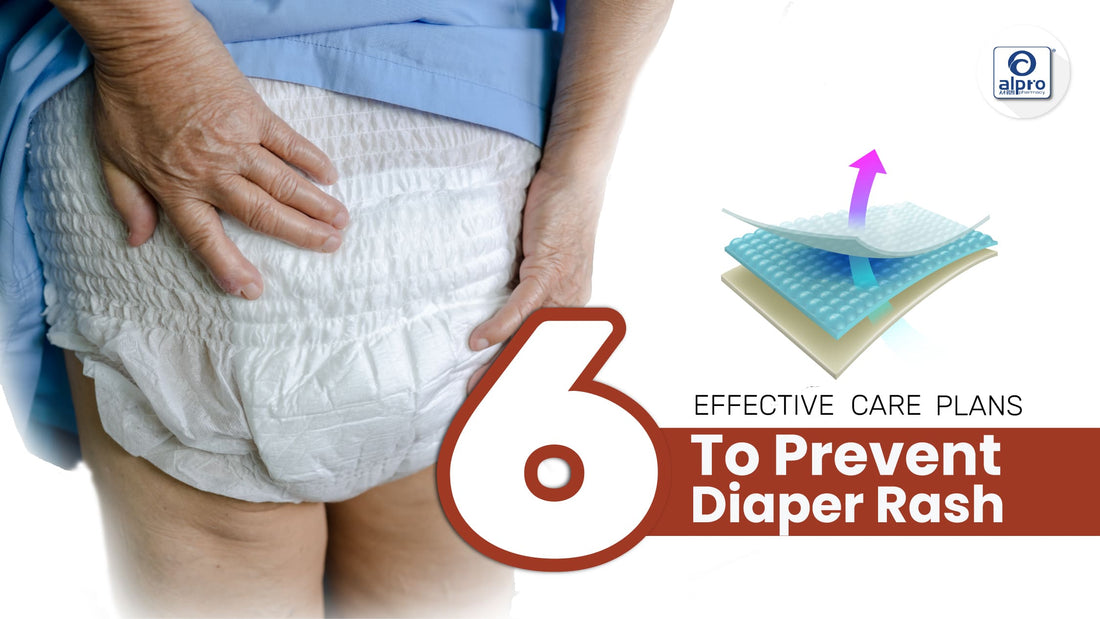 Featured image for What are the 6 Effective Care Plans To Prevent Diaper Rash?