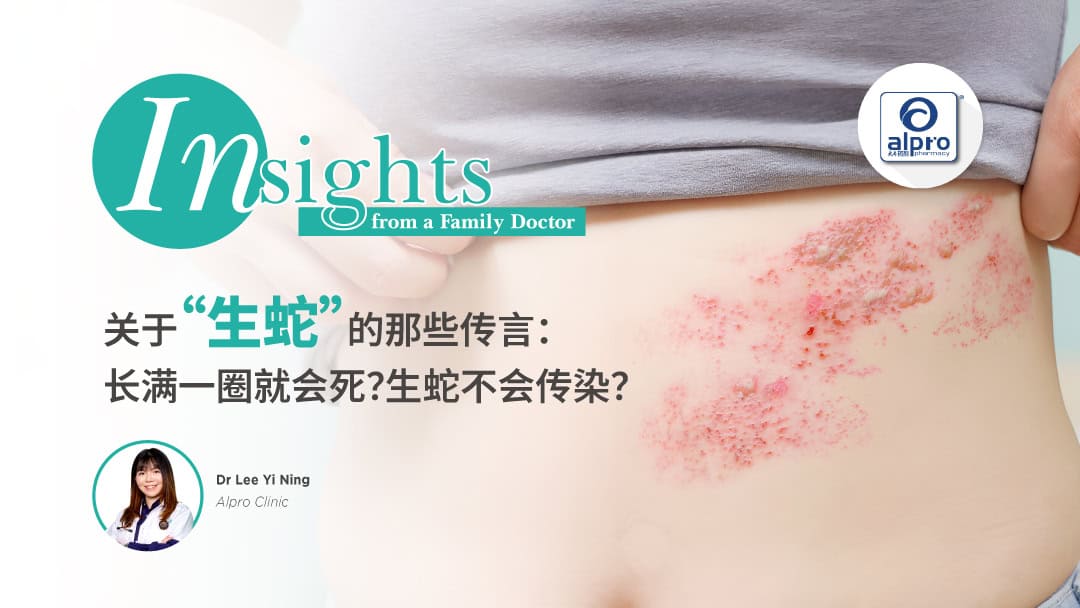 Featured image for 关于“生蛇”的那些传言：长满一圈就会死？生蛇不会传染？