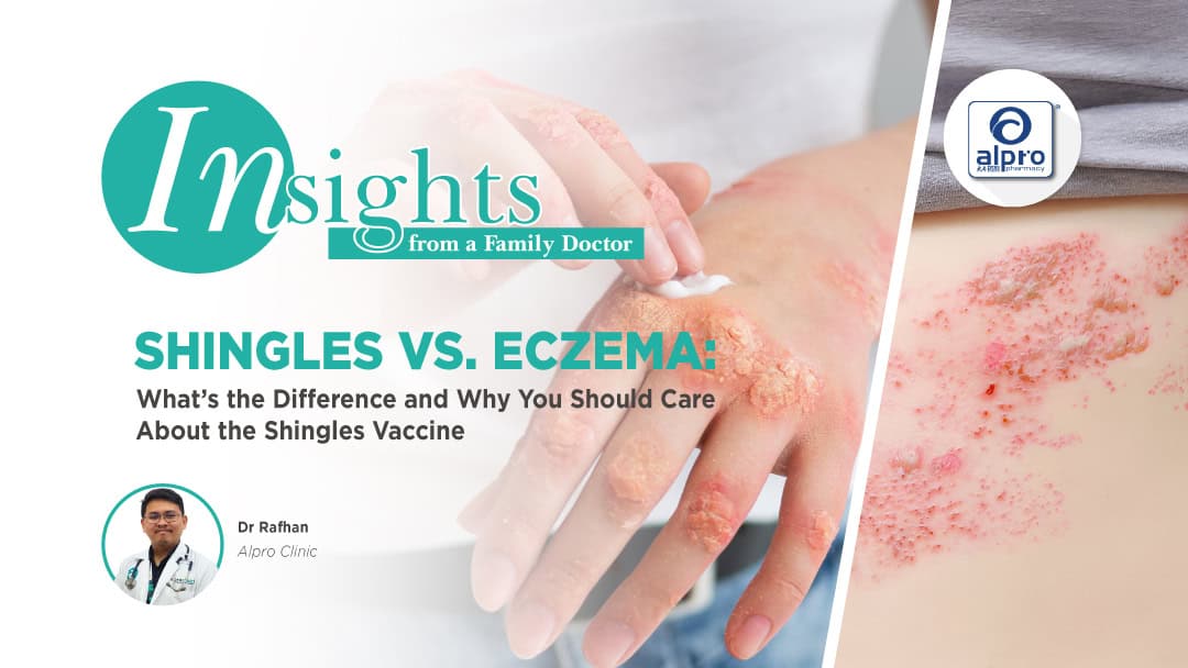 Featured image for Shingles vs. Eczema: What’s the Difference and Why You Should Care About the Shingles Vaccine