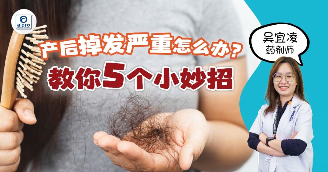 Featured image for 产后掉发严重怎么办？教你5个小妙招