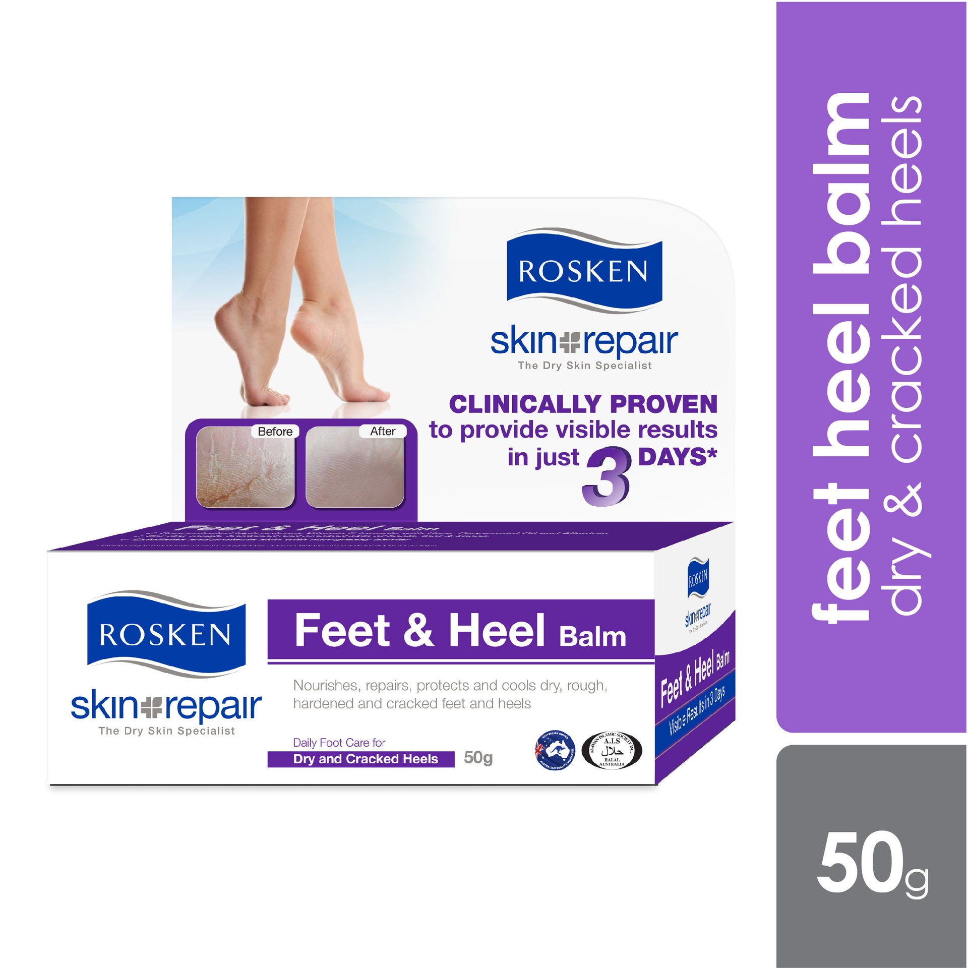 Rosken Feet Heel Balm 50g Dry Cracked Heels Alpro Pharmacy