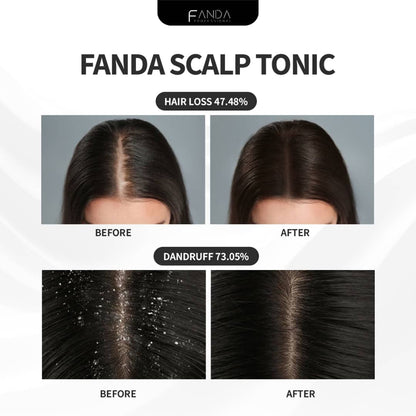 Fanda Scalp Tonic 100mL | Nourish & Strengthen Hair Roots FANDA