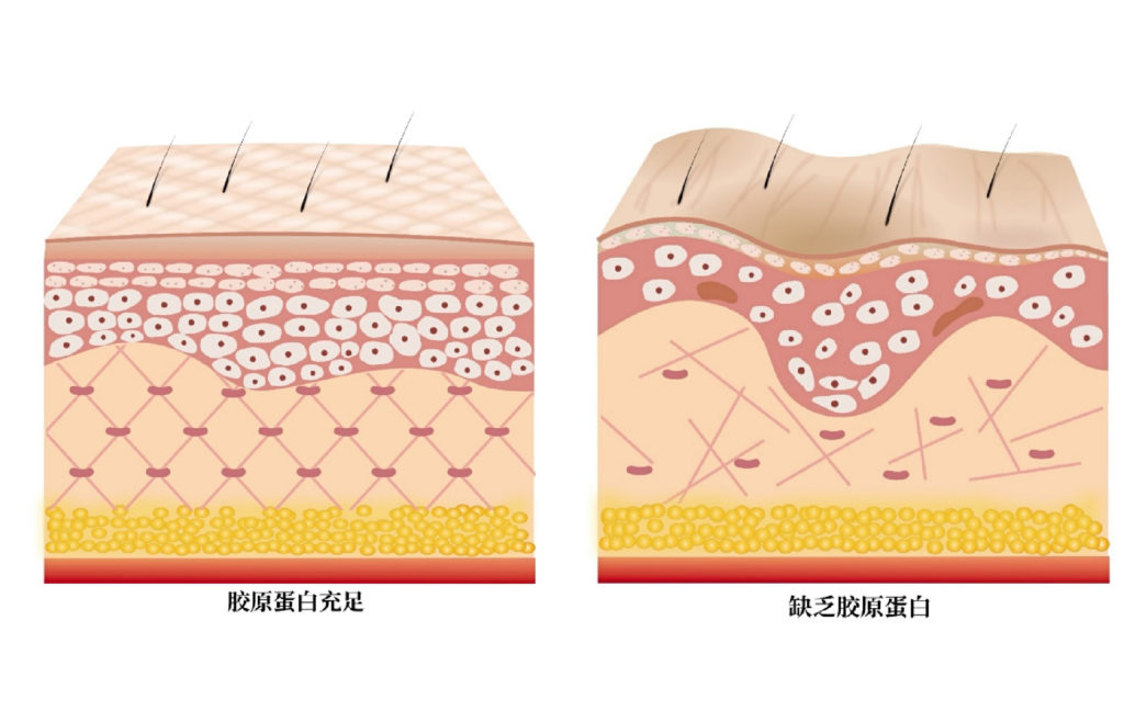 Skin degenerate as we aged.