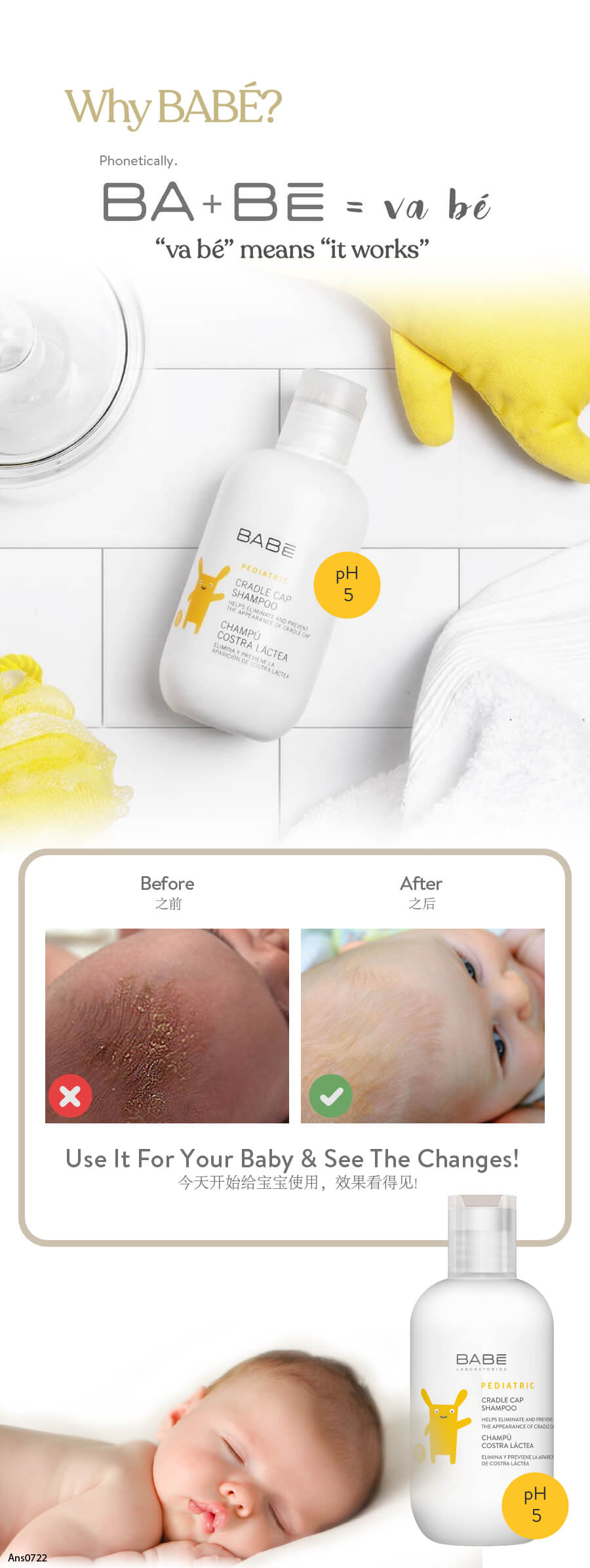 Babe Laboratorios Cradle Cap Shampoo - Champú para costra láctea de bebés  con extracto de caléndula