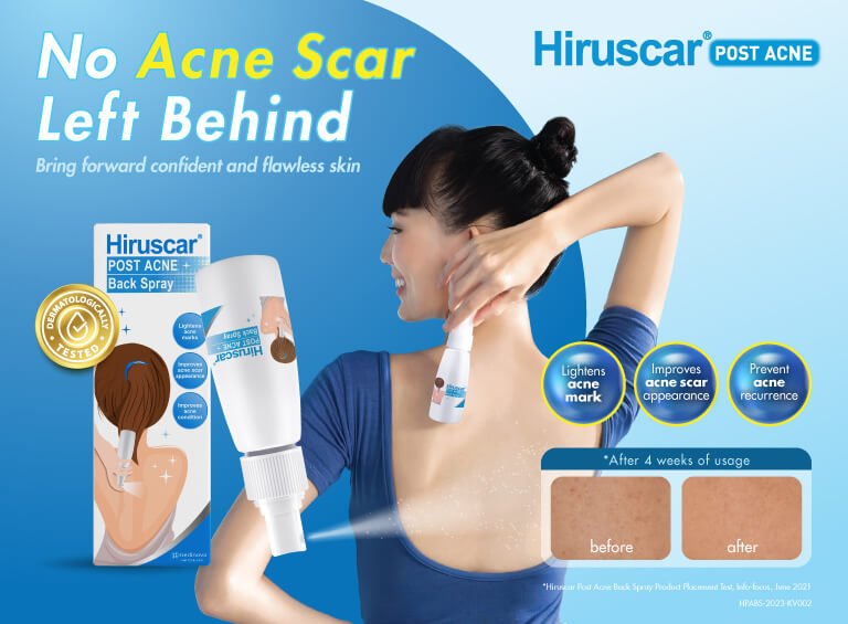 Hiruscar Anti-Acne Advance Spot Gel 10g | Rapid Scar & Acne Treatment in 24 Hours