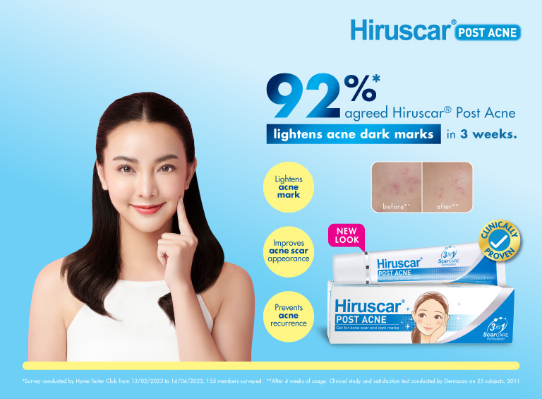 Hiruscar Post Acne Back Spray 50ml | Fights Body Acne