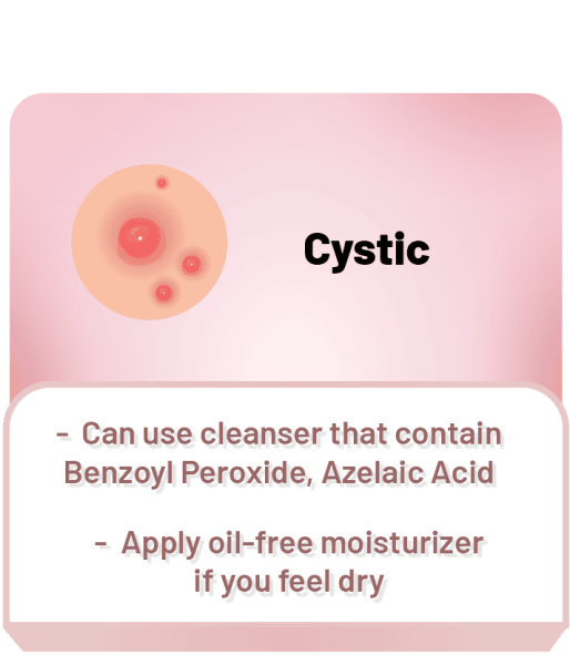 cystic acne