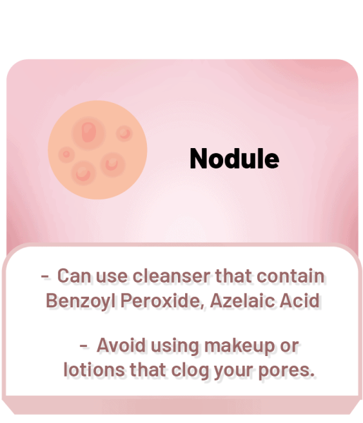 nodule acne