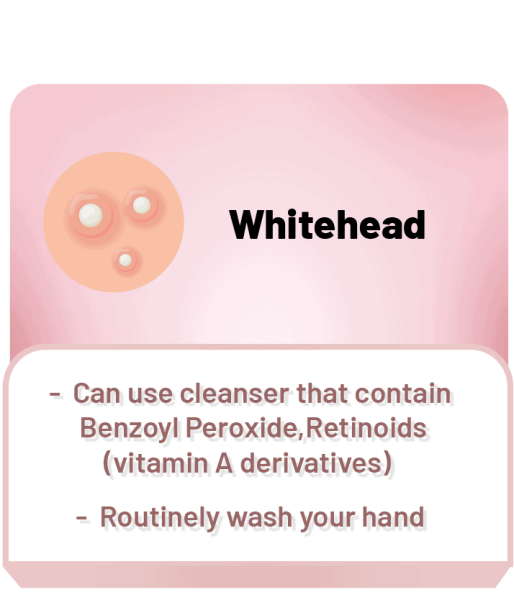 whitehead